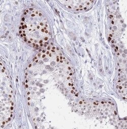 PSMB5 Antibody, Novus Biologicals 0.1 mL; Unconjugated:Antibodies, Polyclonal