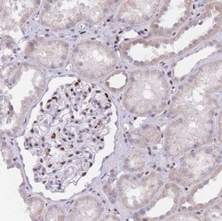 PSMB5 Antibody, Novus Biologicals 0.1 mL; Unconjugated:Antibodies, Polyclonal