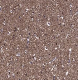 HCN1 Antibody, Novus Biologicals 0.1 mL; Unconjugated:Antibodies, Polyclonal