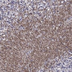 HCN1 Antibody, Novus Biologicals 0.1 mL; Unconjugated:Antibodies, Polyclonal