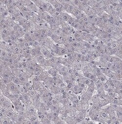 HCN1 Antibody, Novus Biologicals 0.1 mL; Unconjugated:Antibodies, Polyclonal