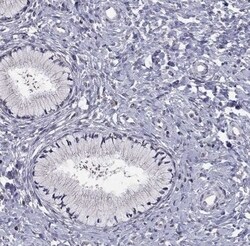 HCN1 Antibody, Novus Biologicals 0.1 mL; Unconjugated:Antibodies, Polyclonal