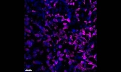 Cytokeratin, pan Antibody (PAN-CK (Cocktail)), Novus Biologicals:Antibodies:Primary