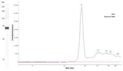 Fascin Antibody (FSCN1/417), Novus Biologicals:Antibodies:Primary Antibodies