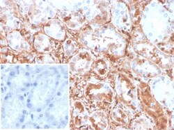 Transgelin/TAGLN/SM22 alpha Antibody (TAGLN/247), Novus Biologicals:Antibodies:Primary