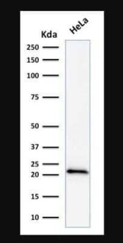 p21/CIP1/CDKN1A Antibody (DCS-60.2), Novus Biologicals:Antibodies:Primary