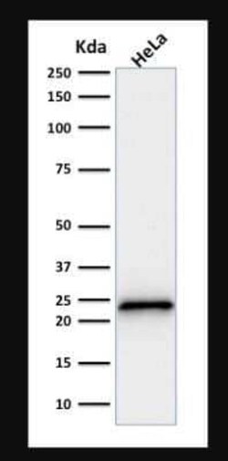 p21/CIP1/CDKN1A Antibody (SPM306), Novus Biologicals:Antibodies:Primary