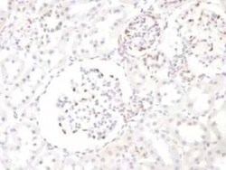 WT1 Antibody (WT1/857), Novus Biologicals 0.02mg; Unlabeled:Antibodies,