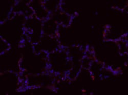 EpCAM/TROP1 Antibody (EGP40/1110) - (ECD), Novus Biologicals:Antibodies:Primary