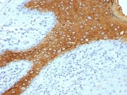 Cytokeratin 10 Antibody (KRT10/844 + KRT10/1275), Novus Biologicals:Antibodies:Primary