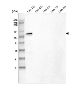 Laminin beta 3 Antibody (CL3363), Novus Biologicals:Antibodies:Primary