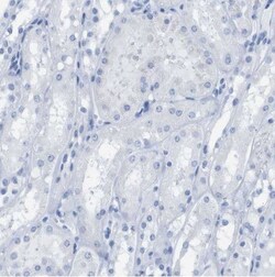 Kv1.3 Antibody, Novus Biologicals:Antibodies:Primary Antibodies