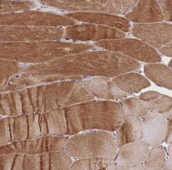 Triadin Antibody, Novus Biologicals 0.1 mL, Unconjugated:Antibodies, Polyclonal