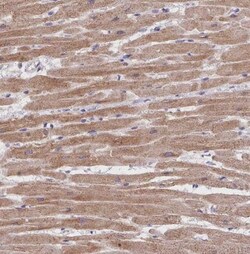 Triadin Antibody, Novus Biologicals 0.1 mL, Unconjugated:Antibodies, Polyclonal