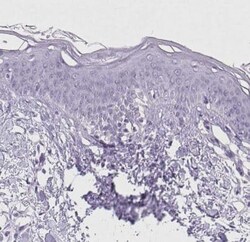 Triadin Antibody, Novus Biologicals 0.1 mL, Unconjugated:Antibodies, Polyclonal