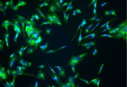 Clathrin Heavy Chain 1/CHC17 Antibody, Novus Biologicals 25 &mu;L | Buy Online | Novus Biologicals | Fisher Scientific