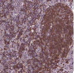 ACAD10 Antibody, Novus Biologicals 25 &mu;L, Unconjugated:Antibodies, Polyclonal