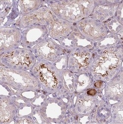 ACAD10 Antibody, Novus Biologicals 25 &mu;L, Unconjugated:Antibodies, Polyclonal