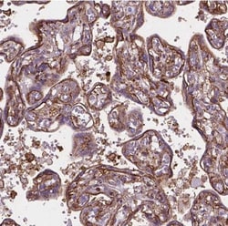 ACAD10 Antibody, Novus Biologicals 25 &mu;L, Unconjugated:Antibodies, Polyclonal
