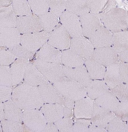 ACAD10 Antibody, Novus Biologicals 25 &mu;L, Unconjugated:Antibodies, Polyclonal