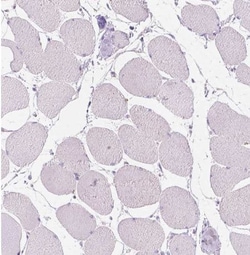CUZD1 Antibody, Novus Biologicals 0.1 mL, Unconjugated:Antibodies, Polyclonal