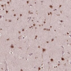 NFAT5 Antibody, Novus Biologicals 25 &mu;L | Buy Online | Novus Biologicals | Fisher Scientific