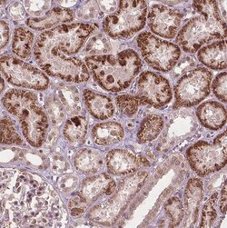 NFAT5 Antibody, Novus Biologicals 25 &mu;L | Buy Online | Novus Biologicals | Fisher Scientific