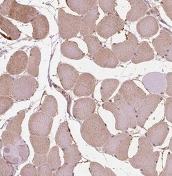 NFAT5 Antibody, Novus Biologicals 25 &mu;L | Buy Online | Novus Biologicals | Fisher Scientific