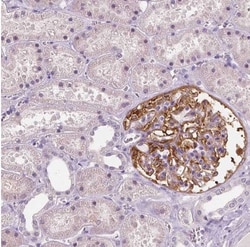 NECAB1 Antibody (CL0580), Novus Biologicals 0.1 mL, Unconjugated:Antibodies,