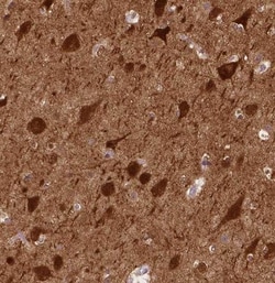 NECAB1 Antibody (CL0576), Novus Biologicals 25 &mu;L, Unconjugated:Antibodies,