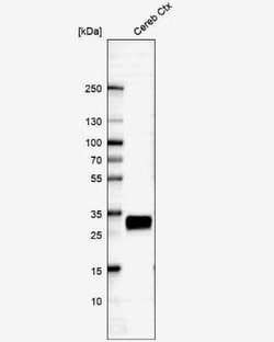 CD90/Thy1 Antibody (CL1028), Novus Biologicals 0.1 mL, Unconjugated:Antikroppar