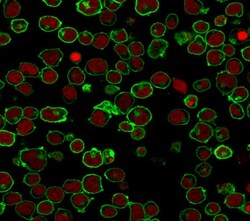 B220/CD45R Antibody (PTPRC/1461), Novus Biologicals 100&mu;g; Unlabeled:Antibodies,