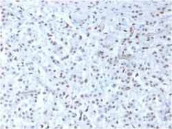 WT1 Antibody (rWT1/857), Novus Biologicals:Antibodies:Primary Antibodies