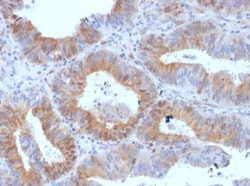 LHR Antibody (LHCGR/1417), Novus Biologicals 20&mu;g; Unlabeled:Antibodies,
