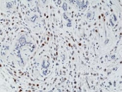 Histone H3, p Thr3 Antibody (RM159), Novus Biologicals 100 &mu;g | Buy Online | Novus Biologicals | Fisher Scientific