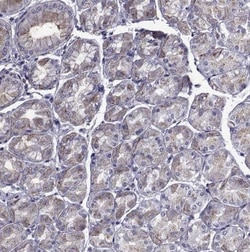 PDE6H Antibody, Novus Biologicals:Antibodies:Primary Antibodies