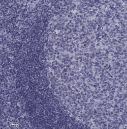 PDE6H Antibody, Novus Biologicals:Antibodies:Primary Antibodies