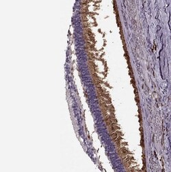 Cav1.4 Antibody, Novus Biologicals 25 &mu;L | Buy Online | Novus Biologicals | Fisher Scientific