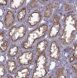 Cav1.4 Antibody, Novus Biologicals 25 &mu;L | Buy Online | Novus Biologicals | Fisher Scientific