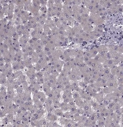 Cav1.4 Antibody, Novus Biologicals 25 &mu;L | Buy Online | Novus Biologicals | Fisher Scientific