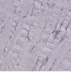 Cav1.4 Antibody, Novus Biologicals 25 &mu;L | Buy Online | Novus Biologicals | Fisher Scientific