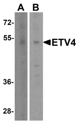 Pea3 Antibody - BSA Free, Novus Biologicals 0.1 mg | Buy Online | Novus Biologicals | Fisher Scientific