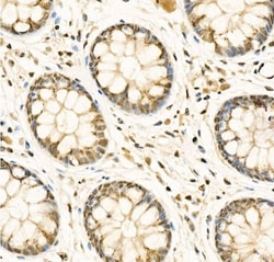 ADAR Antibody - BSA Free, Novus Biologicals:Antibodies:Primary Antibodies