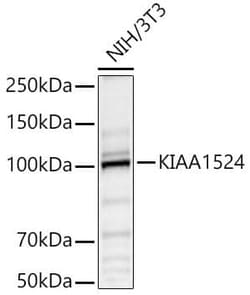 CIP2A Antibody - Azide and BSA Free, Novus Biologicals 0.02 mL, Unconjugated:Antibodies,
