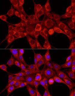 TIMM23 Antibody - Azide and BSA Free, Novus Biologicals:Antibodies:Primary