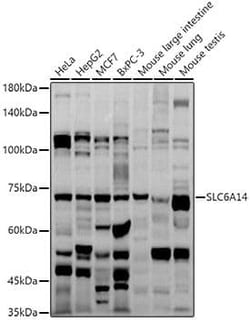 SLC6A14 Antibody - Azide and BSA Free, Novus Biologicals 0.02 mL, Unconjugated:Antibodies,