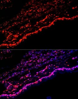 SPRR1A Antibody - Azide and BSA Free, Novus Biologicals 0.1 mL, Unconjugated:Antibodies,