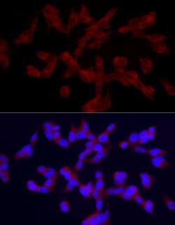 TRPC5 Antibody - Azide and BSA Free, Novus Biologicals 0.02 mL; Unconjugated:Antibodies,