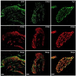 PTPRD Antibody - BSA Free, Novus Biologicals 0.1 mL; Unconjugated:Antibodies,