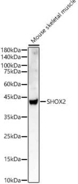 SHOX2 Antibody - BSA Free, Novus Biologicals:Antibodies:Primary Antibodies